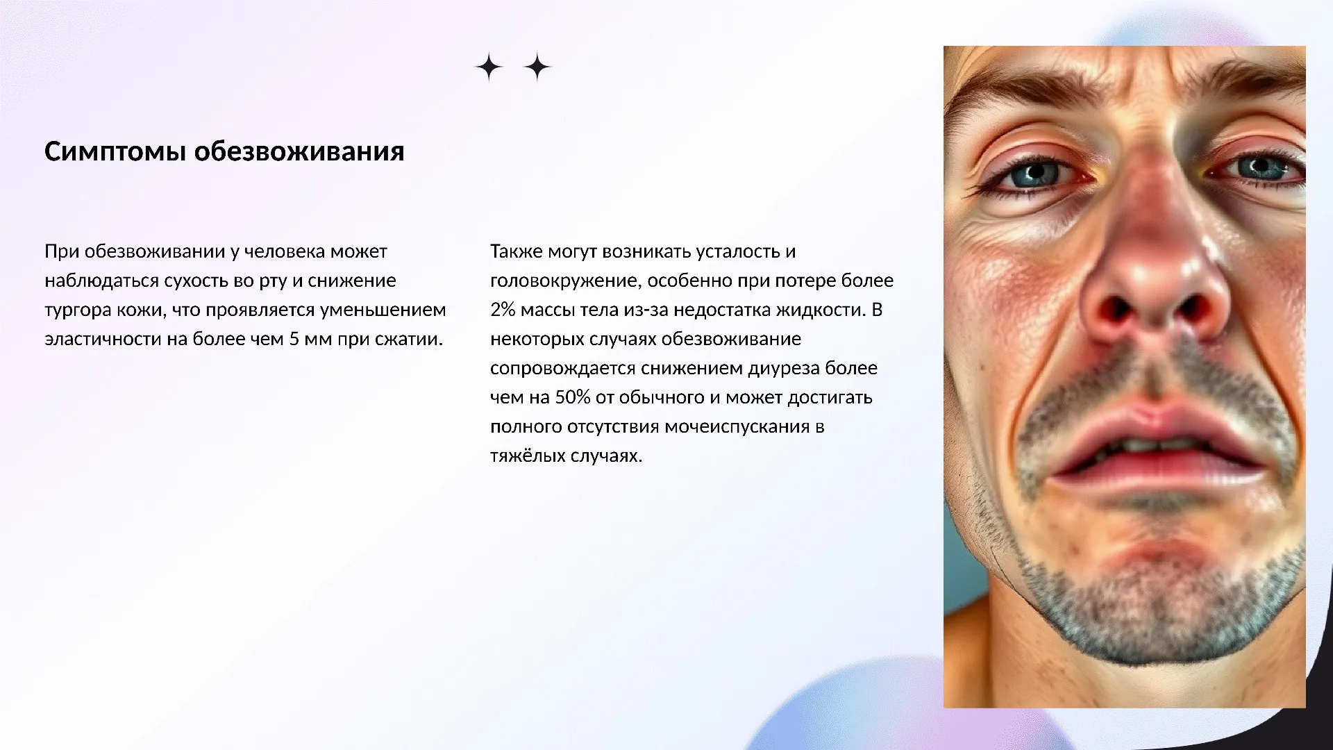 Симптомы обезвоживания - слайд для презентации на тему 
