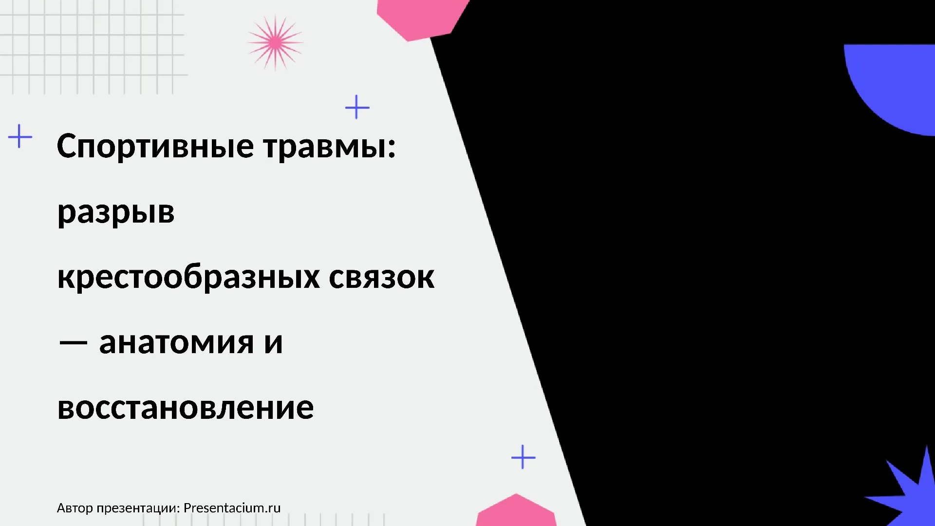 Спортивные травмы: Разрыв крестообразных связок — анатомия и восстановление.
