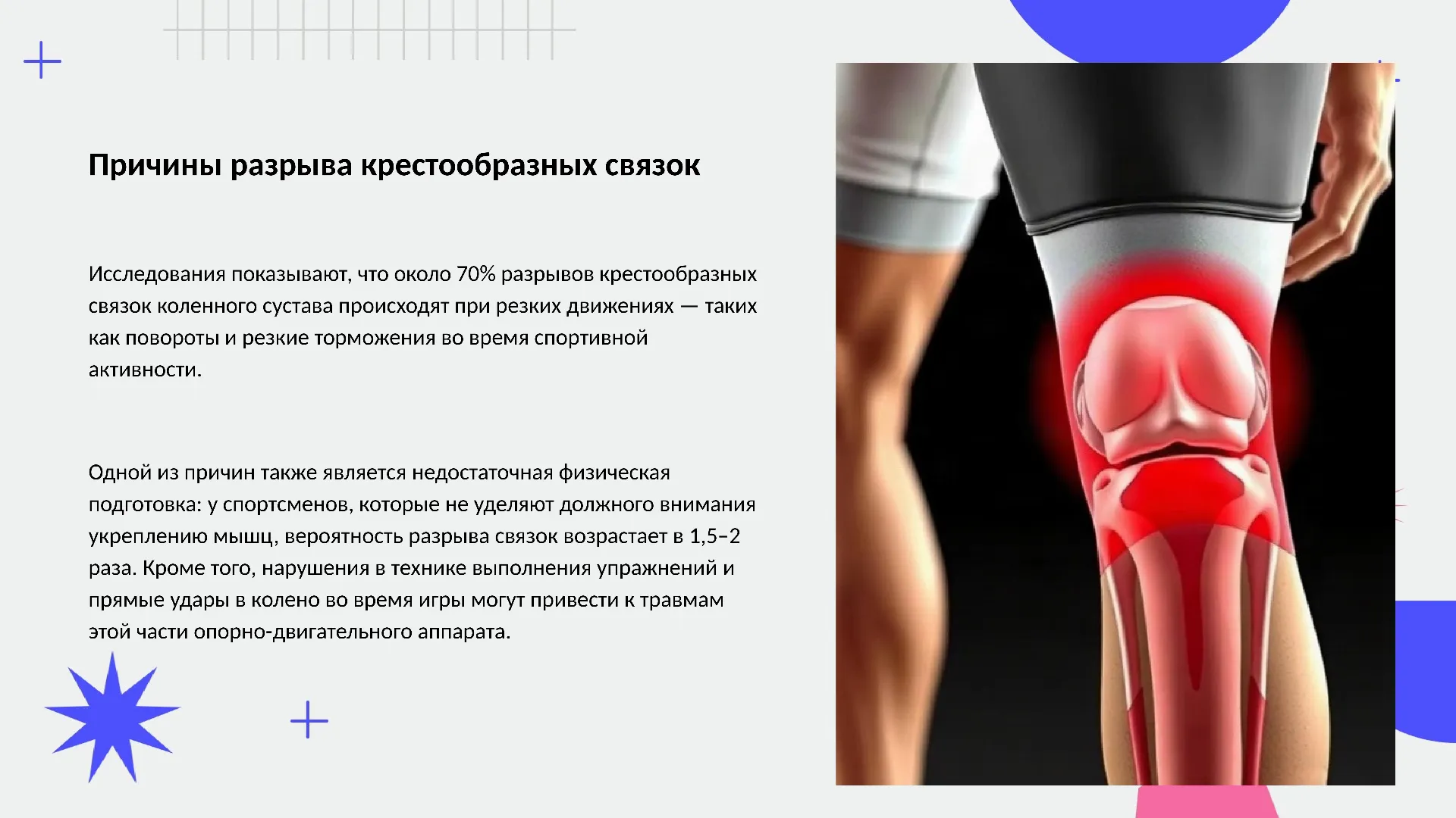 Причины разрыва крестообразных связок - слайд для презентации на тему 