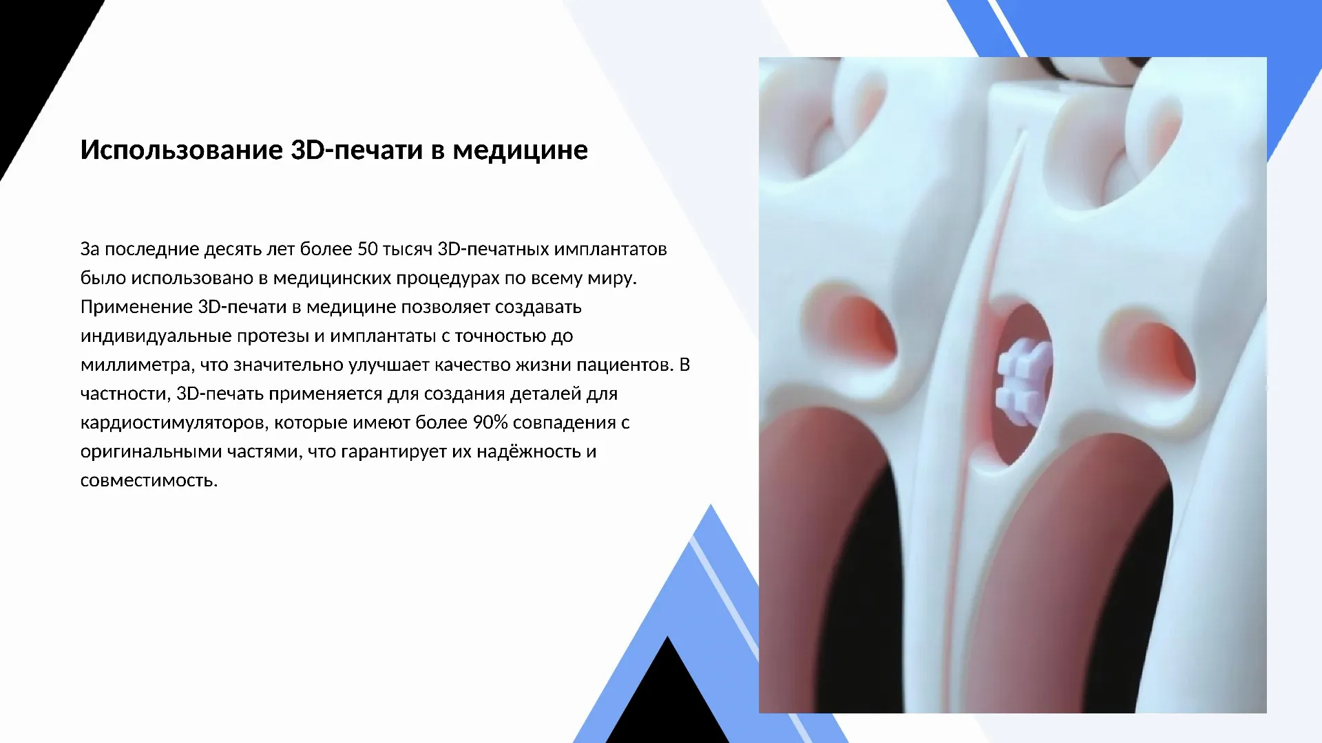 Использование 3D-печати в медицине - слайд для презентации на тему 